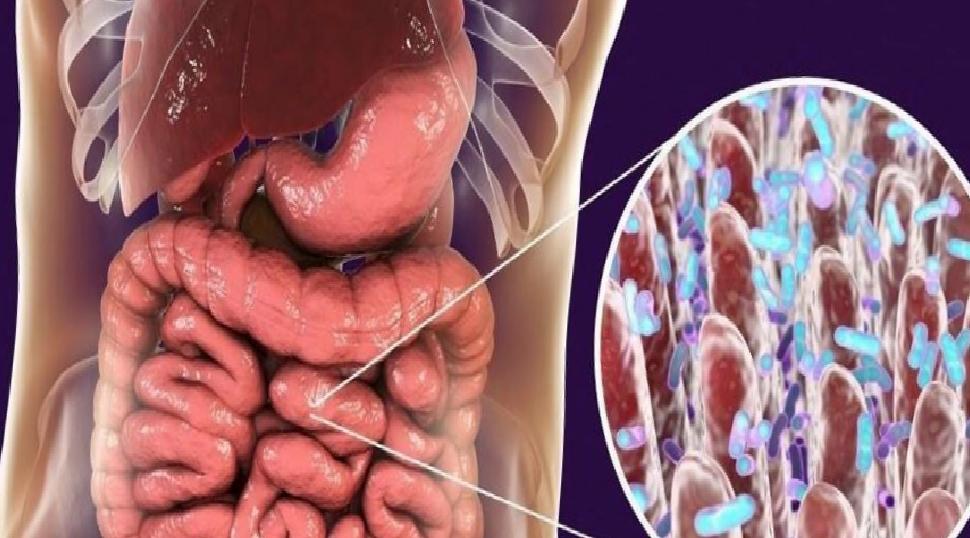 Nörovirüs Vakaları ve Çocuk Sağlığı: Belirtiler, Bulaşma ve Erken Müdahalenin Önemi