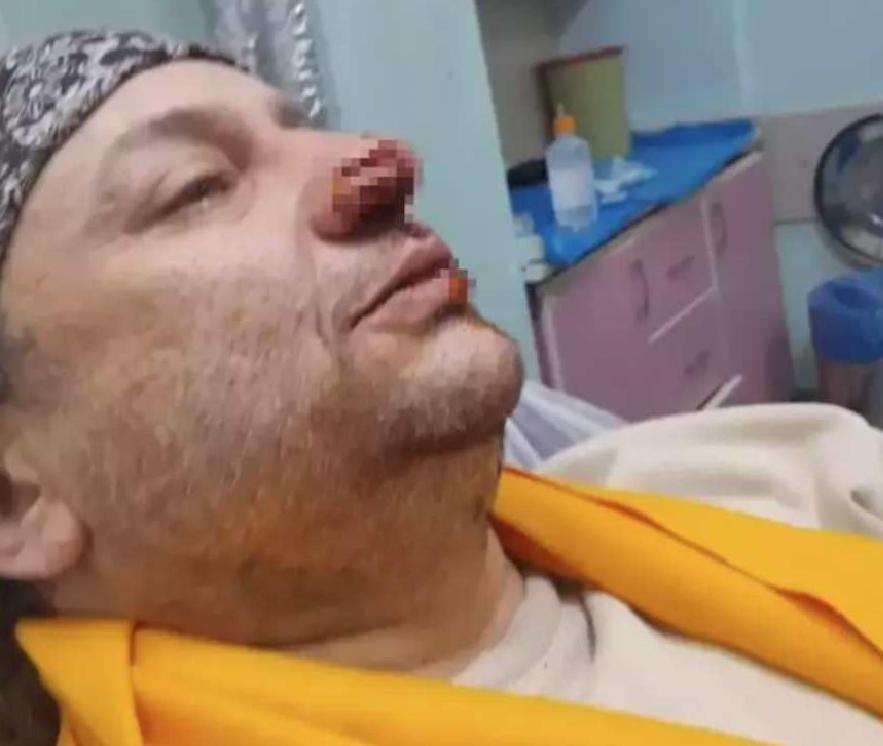 Onur Akay: Nekrotizan Fasiit sonrası yoğun bakım macerası ve yaşadığı zorluklar