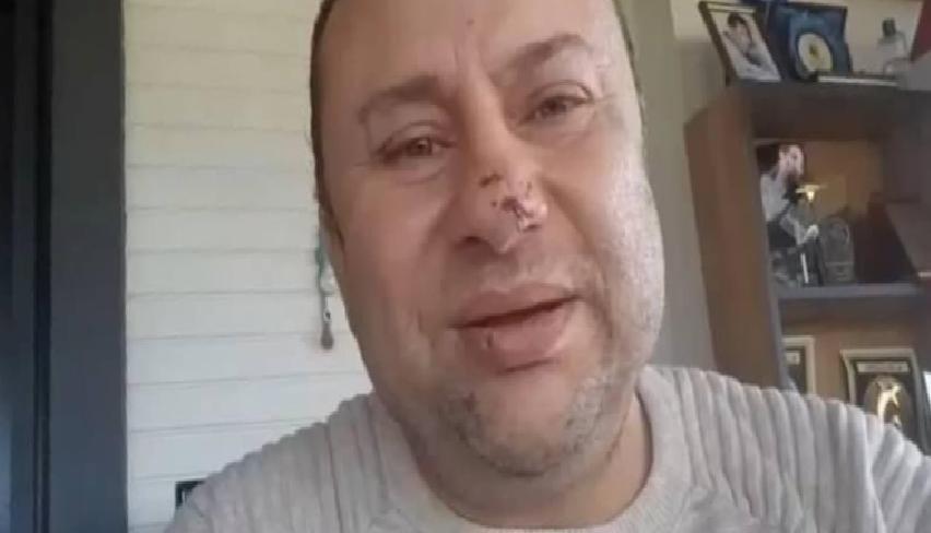 Onur Akay: Nekrotizan Fasiit sonrası yoğun bakım macerası ve yaşadığı zorluklar