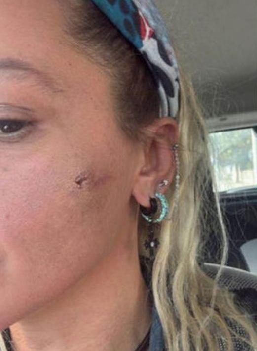 Yıldız Asyalı: Eşinin ve Babasının Şiddet Görüldüğüne Dair Yeni İddialar