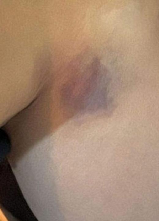 Yıldız Asyalı: Eşinin ve Babasının Şiddet Görüldüğüne Dair Yeni İddialar