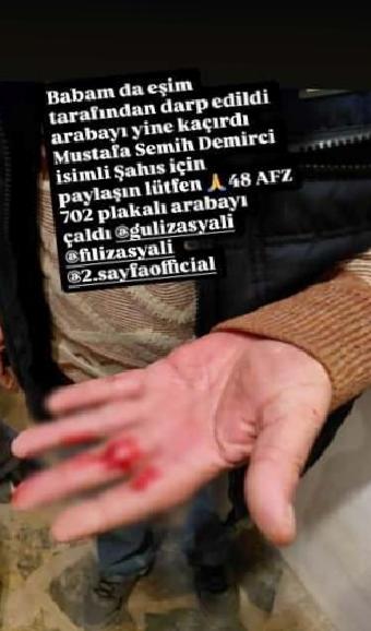 Yıldız Asyalı: Eşinin ve Babasının Şiddet Görüldüğüne Dair Yeni İddialar