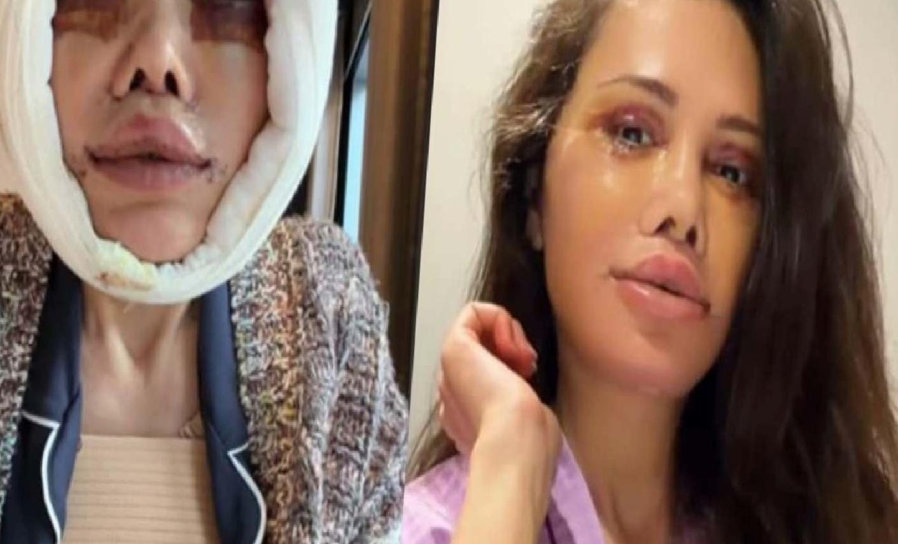 Yüz Nakli Sonrası Değişim ve Sosyal Medyada Gelen Yorumlar: Didem Ceran’ın Güncel Durumu