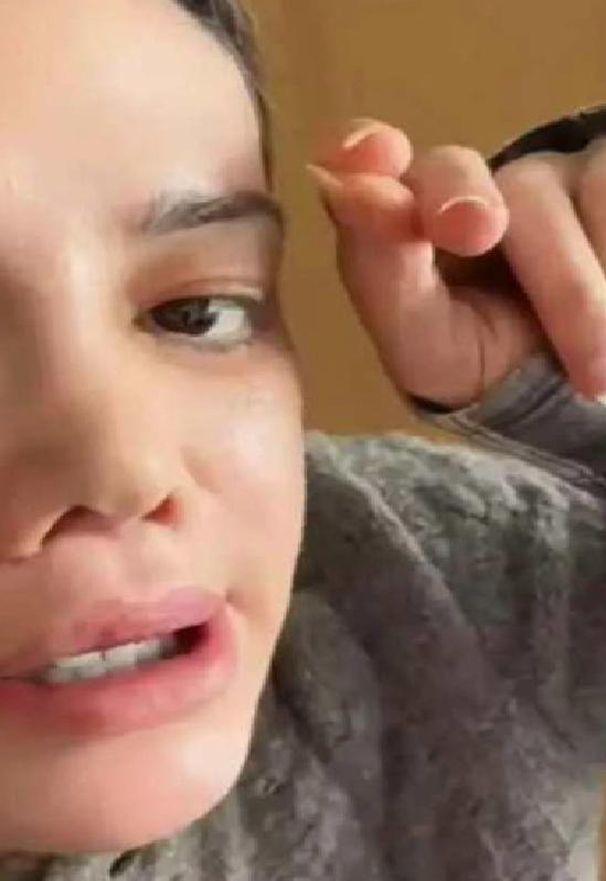 Yüz Nakli Sonrası Değişim ve Sosyal Medyada Gelen Yorumlar: Didem Ceran’ın Güncel Durumu