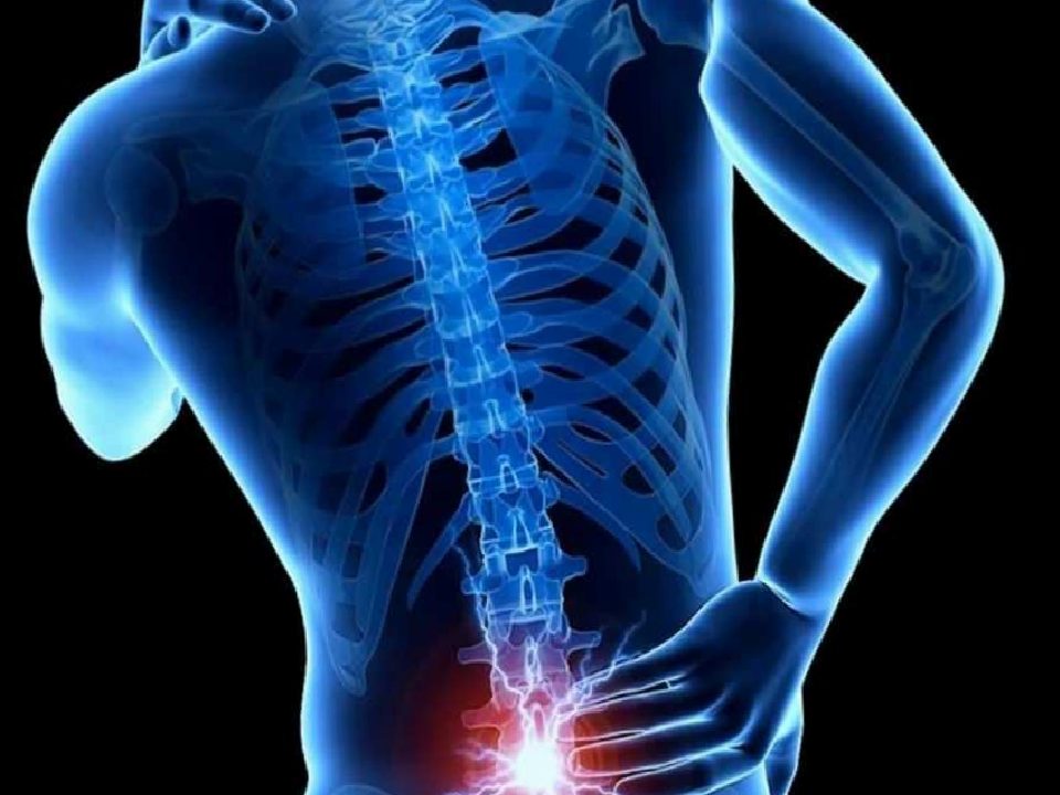 Ankilozan Spondilit ve Bel Ağrısında Erken Tanı ile Bütüncül Tedavi Yaklaşımı