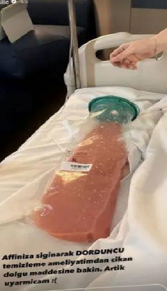 Aquafilling: Sağlık Riskleri ve Vücutta Kalıcı Etkiler Üzerine Bilgilendirici İnceleme