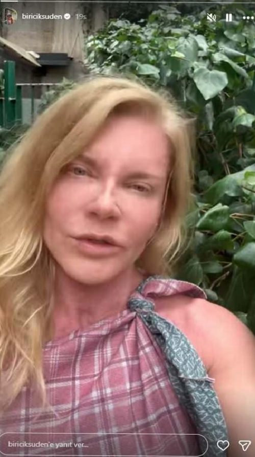 Biricik Suden: Dermapen Sonrası Tartışmalara Net Yanıt ve Ruh Sağlığı Üzerine Sorgulamalar