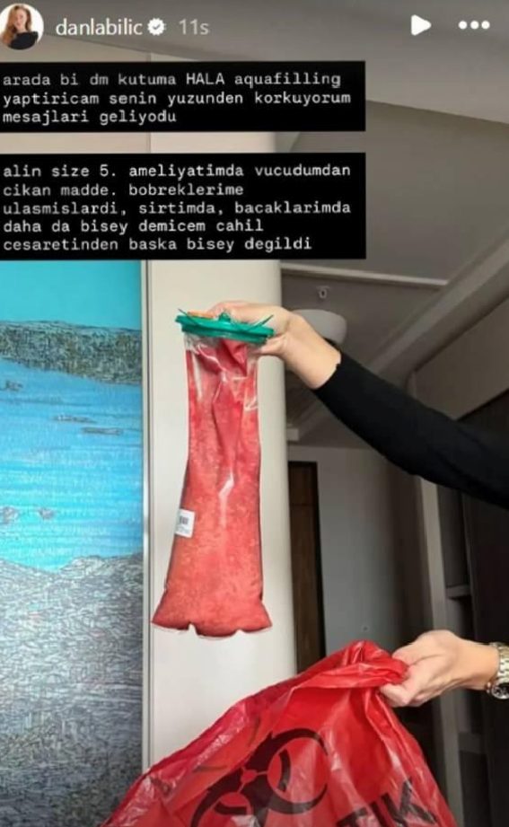 Danla Bilic: Sağlık Gündeminde Güncel Gelişmeler ve Önceki Operasyonların Gölgesindeki Durum