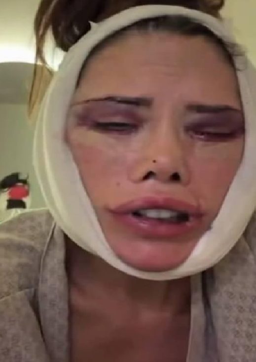 Didem Ceran: Yüz Revizyonu ve Tedavi Süreci Üzerine Güncel Gelişmeler