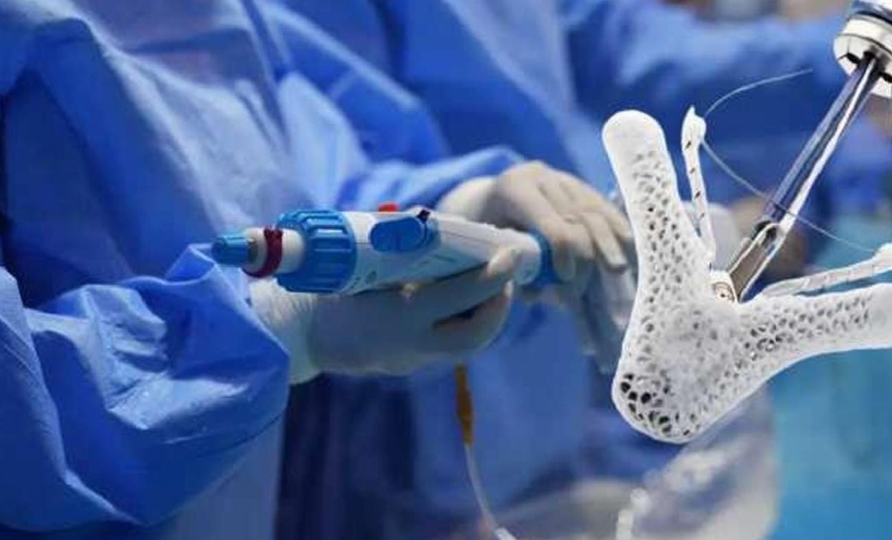 Mitral Kapak Mandallama ile Yaşamaya Dönüş: 70 Gün Yoğun Bakım Sonrası Yeniden Yürümenin Hikayesi