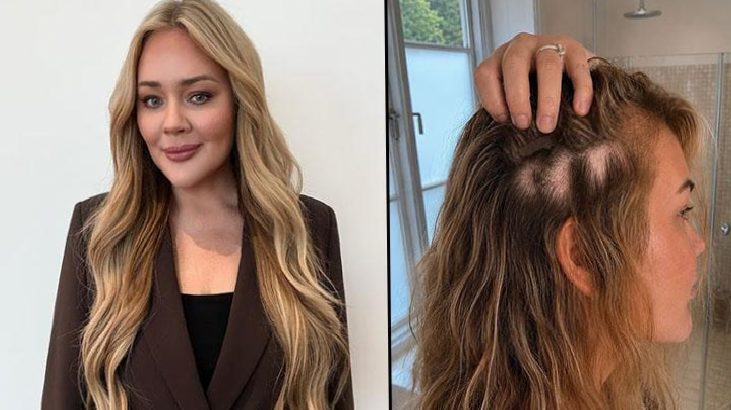Split image: left shows a woman with long blonde wavy hair in a dark blazer, smiling; right shows a side view of the same woman with visible thinning at the crown as she parts her hair.