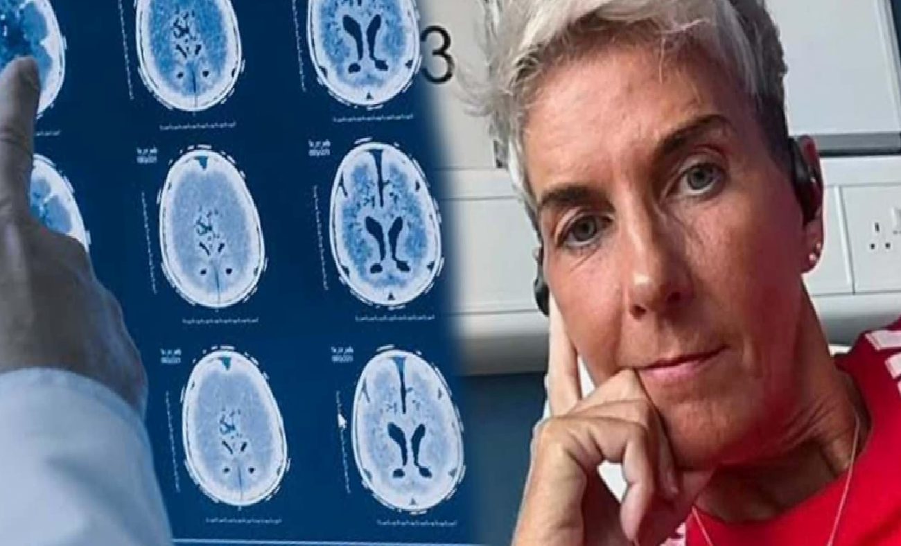 FND ile Gelen Zorluklar: Carmel McConnellogue’un Hikayesi