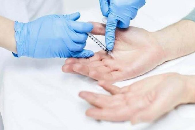 Koltukaltı ve Ellerde Terlemeyi 15 Dakikada Hafifleten Botoks Uygulaması: Yaz Aylarında Yaşam Kalitesini Artıran Güvenilir Yöntem