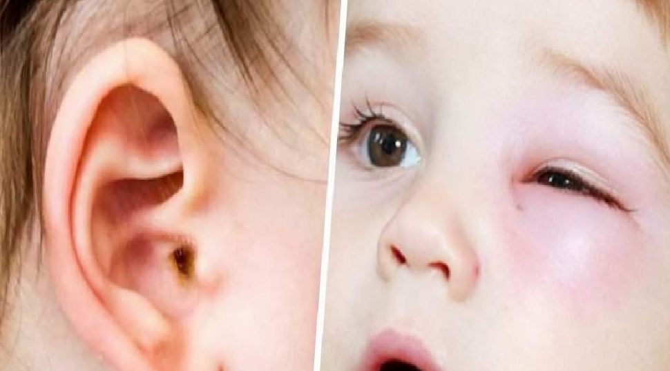 Yaz Havuzları: Çocuk Sağlığı İçin Hijyen ve Enfeksiyon Uyarıları