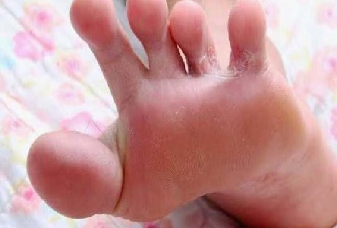 Yaz Havuzları: Çocuk Sağlığı İçin Hijyen ve Enfeksiyon Uyarıları