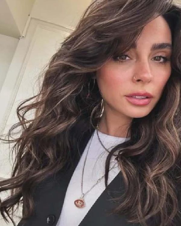 Yasemin Yürdük’ün Kaza Sonrası Yaşadığı Zorlu Günler: Platinli Kaval Kemiği ve Dost Destekleri