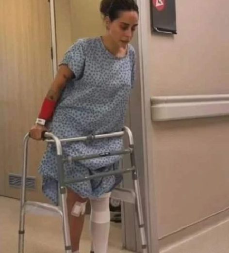 Yasemin Yürdük’ün Kaza Sonrası Yaşadığı Zorlu Günler: Platinli Kaval Kemiği ve Dost Destekleri